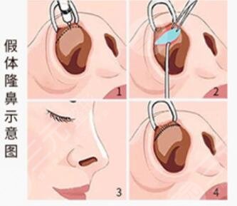 盧建醫(yī)生信息介紹
