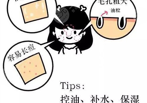 油性皮膚護理方案揭曉