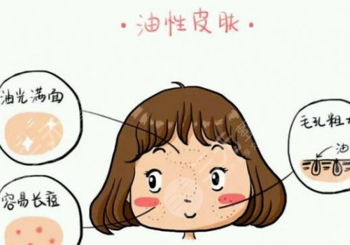 油性皮膚護理方案揭曉