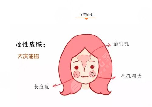 油性皮膚護理方案揭曉