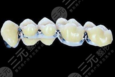 全瓷牙一顆1000元貴嗎？平均價(jià)位是多少？?jī)r(jià)格波動(dòng)的因素