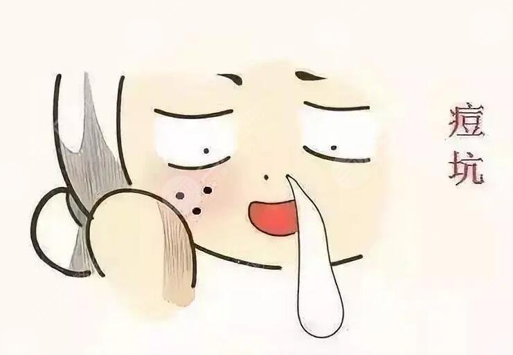 激光磨皮去痘印有效嗎？手術(shù)注意事項(xiàng)有哪些？哪些人適合做？