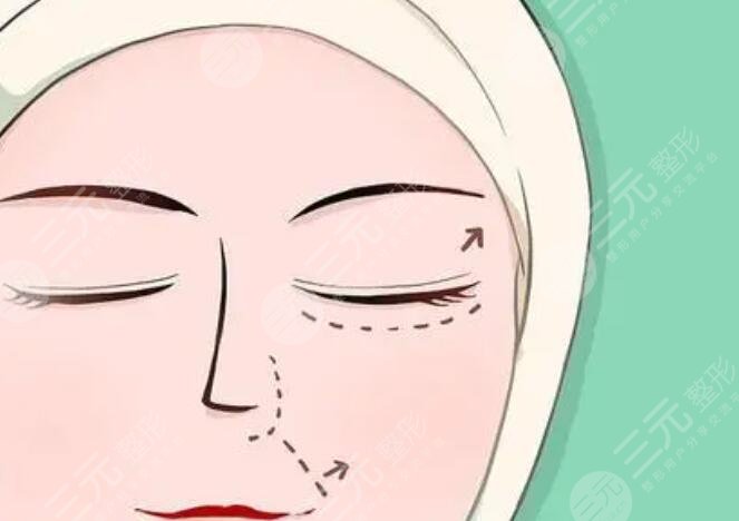 李薇 廣州韓妃李光琴雙眼皮