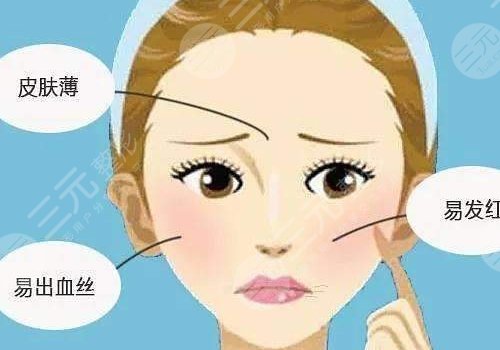 怎么減少紅血絲的產(chǎn)生?