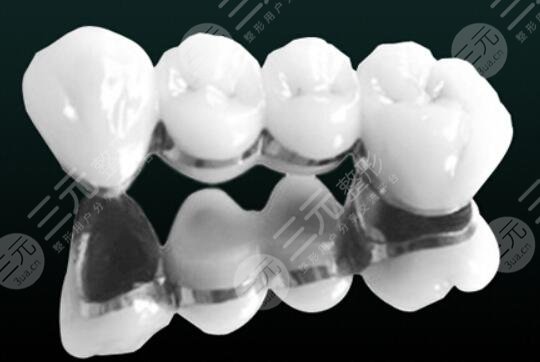 全瓷牙一顆大概多少錢呢?