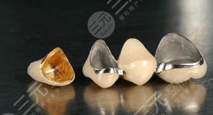 全瓷牙價(jià)格影響的因素