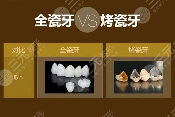全瓷牙一顆大概多少錢呢？文中4個(gè)因素在影響手術(shù)價(jià)格！