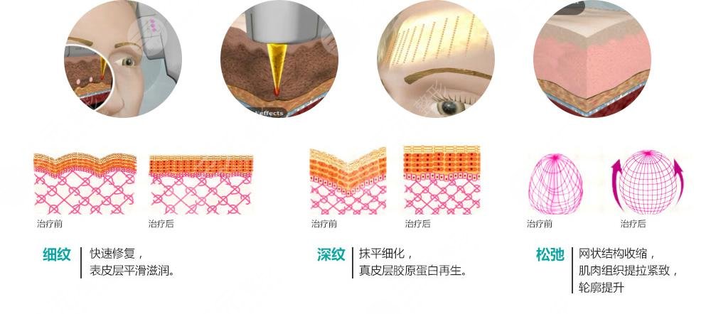 彩光嫩膚的緩解原理