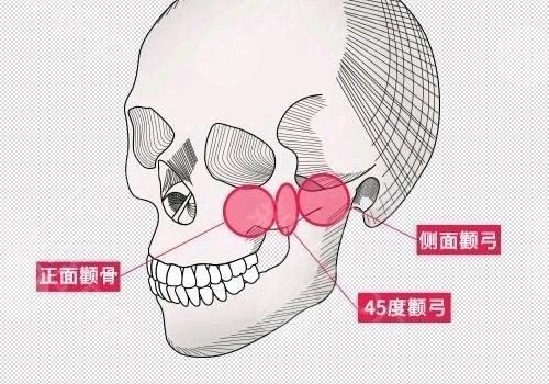 磨骨有什么危害和后遺癥