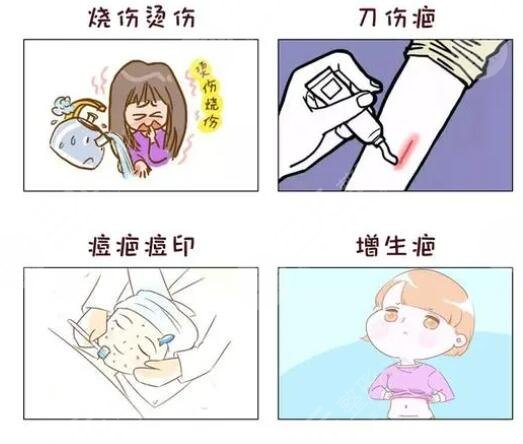 像素激光祛疤多少錢?