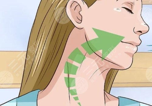 頸紋特別深怎么去除？