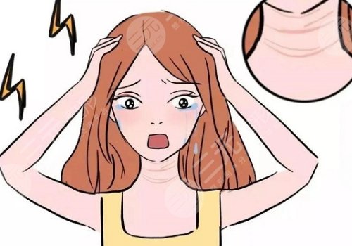 頸紋特別深怎么去除？