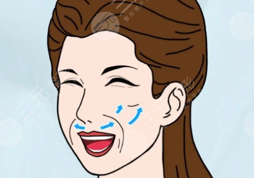 拉皮手術(shù)多大年齡做合適？