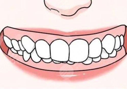 星港華高偉正頜怎么樣?