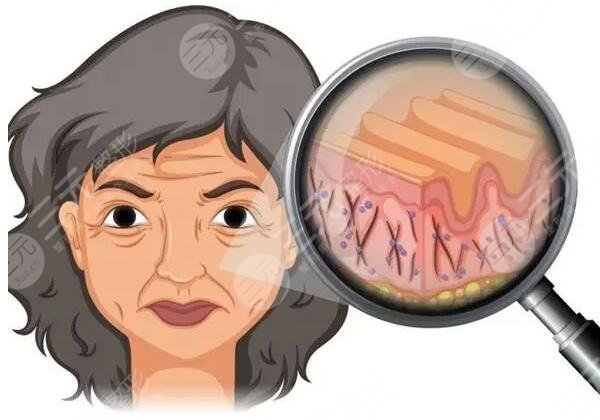 臉部皺紋怎么去除好呢?