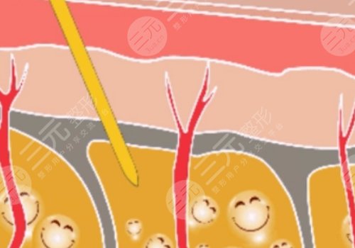 福州海峽醫(yī)療美容整形醫(yī)院怎么樣?