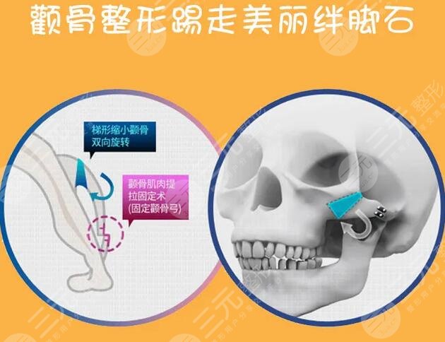 金勇圭顴骨怎么樣?