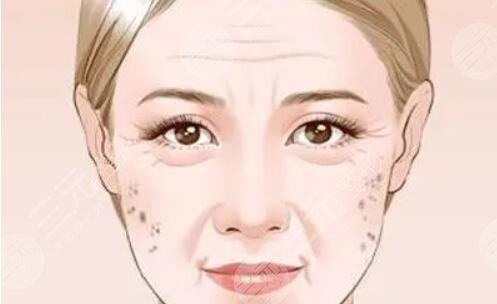 如何消除老年斑有效的方法：食療_醫(yī)美_日常護(hù)理多方面入手！
