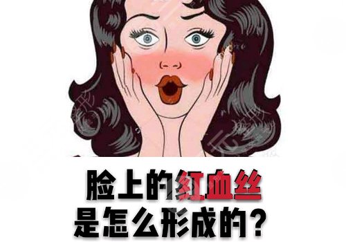 臉上長紅血絲怎么去掉？