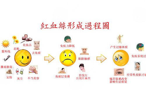 臉上長紅血絲怎么去掉？