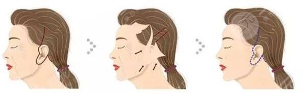 八大處整形醫(yī)院開展項目