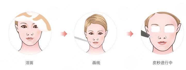 美白注射，水光注射管用嗎?