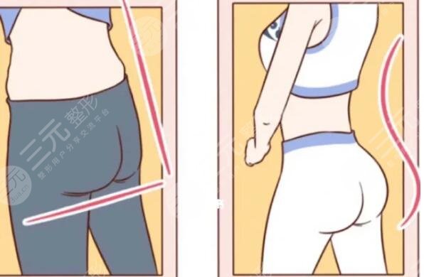 減肥后會反彈嗎?