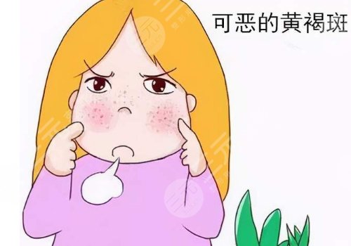 怎樣去除面部黃褐斑有效？