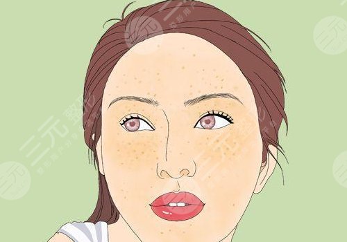 怎樣去除面部黃褐斑有效？