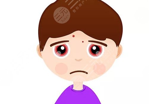 臉上有痘印怎么辦才能去掉呢？