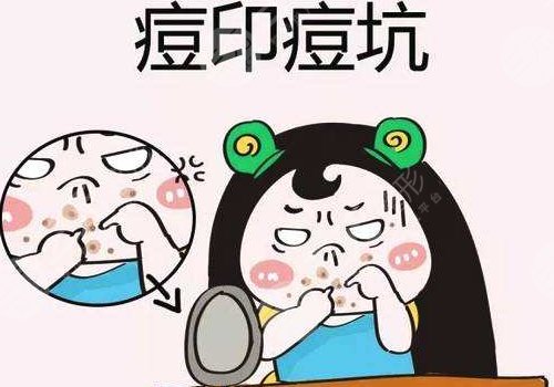 臉上有痘印怎么辦才能去掉呢？