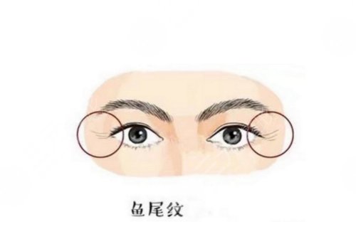 怎么樣去除眼部皺紋？