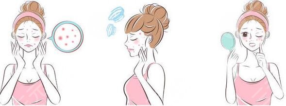 激光緩解鼻子痤瘡要多少錢(qián)?