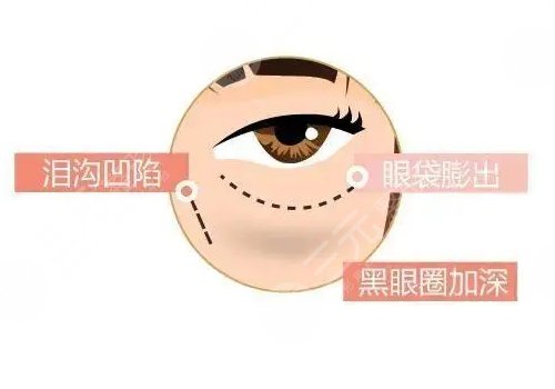 眼周抗衰綜合多少錢做一次？