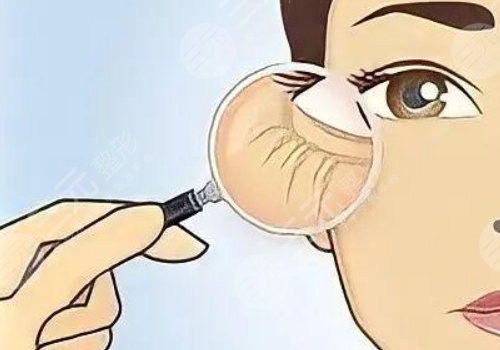 眼周抗衰綜合多少錢做一次？