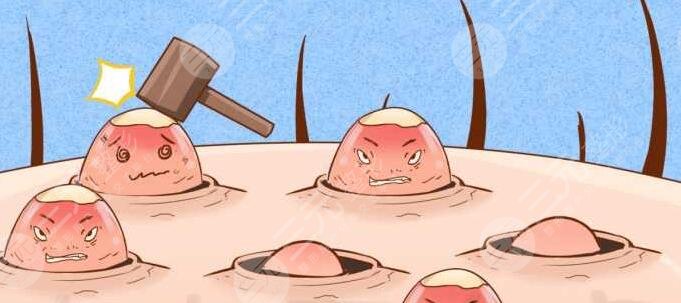 光子嫩膚去痘印應(yīng)該注意哪些問(wèn)題?