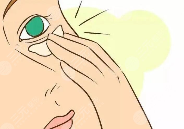 激光去除魚尾紋原理是什么?