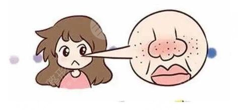 怎樣收縮臉部毛孔粗大的方法