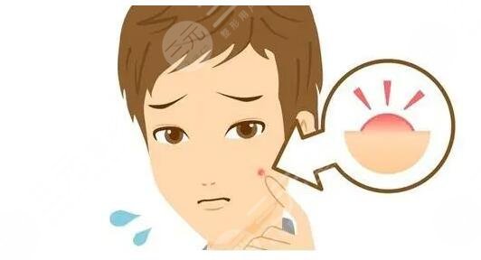 緩解青春痘費(fèi)用多少錢？哪些醫(yī)美方法見效快？