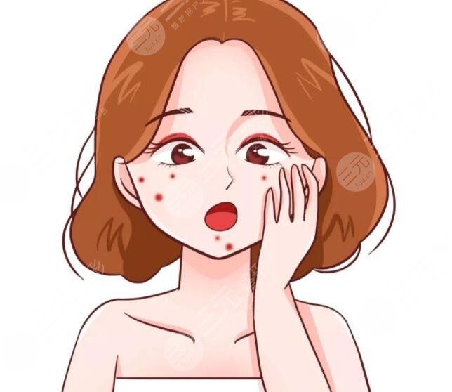 紅藍(lán)光緩解青春痘一次可以嗎?