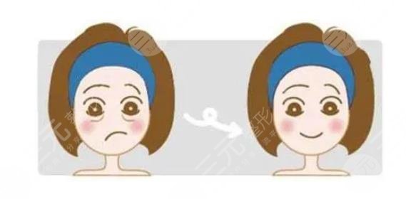 抽脂去眼袋會(huì)反彈嗎