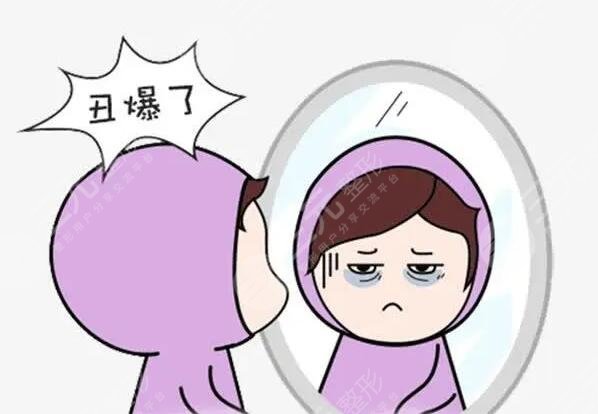 怎樣能夠幫助減輕黑眼圈呢?