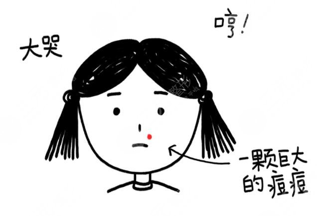 臉上生長了痘痘應(yīng)該注意哪些問題?