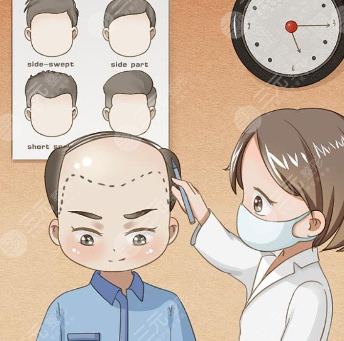 禿頂植發(fā)需要多少錢(qián)