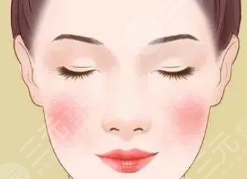 紅血絲激光多少錢(qián)