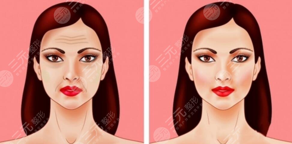 射頻緊膚有什么副作用？