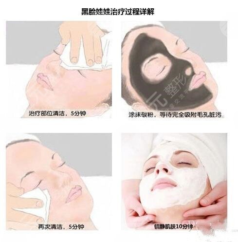 黑臉娃娃有沒(méi)有副作用?功效是什么?