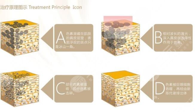 黑臉娃娃的價(jià)格貴不貴?