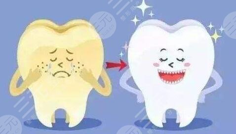 冷光美白牙齒要多少錢(qián)一次?