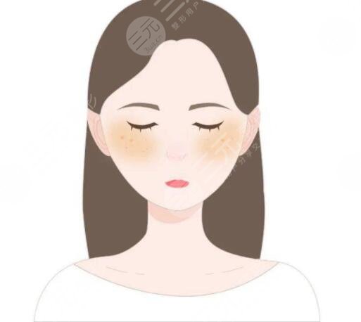 去除黃褐斑價格大概是多少？哪種方式祛斑見效快！